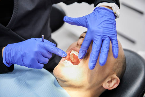 Best Knocked-Out Tooth Emergency  in Morongo Valley, CA